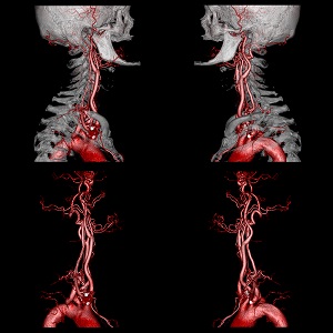 Cardiac CT at Lakemba Radiology